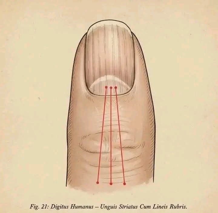 Si tienes rayas en tus uñas significa que tienes ca22…Ver mas